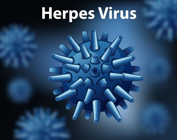 herpes simplex e zoster |herpes zoster sintomi iniziali | herpes zoster immagini