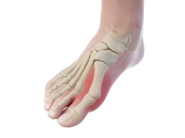 dolore parte superiore del piede | dolore pianta piede esterno | dolore ai piedi al risveglio